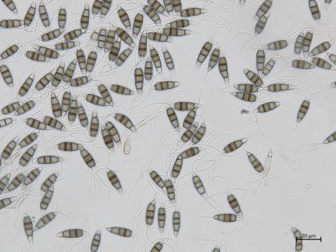 Neopestalotiopsis_sp_2