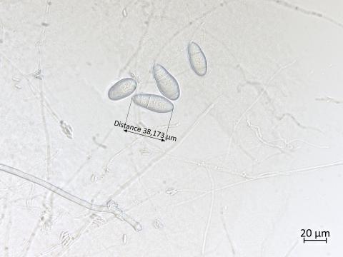 Orbilia_blumenaviensis_3