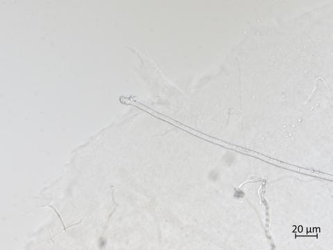 Orbilia_blumenaviensis_5