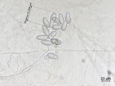 Orbilia_blumenaviensis_4