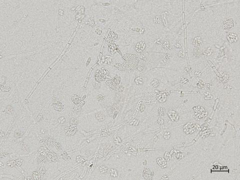 Plectosphaerella_cucumerina_2