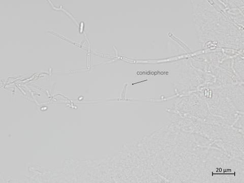 Plectosphaerella_cucumerina_4