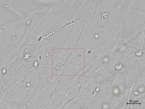 Plectosphaerella_cucumerina_5