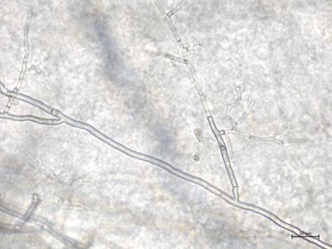 Rhizoctonia_solani_5