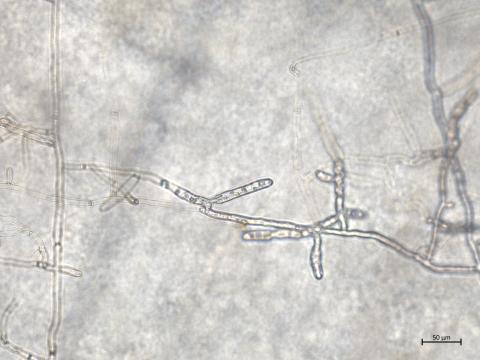 Rhizoctonia_solani_4