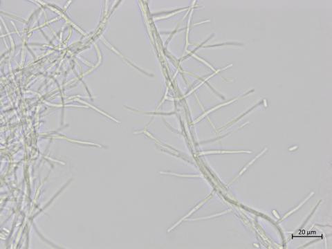 Sarocladium_strictum_4