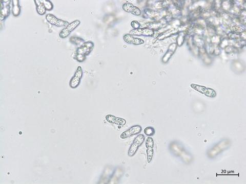 Diplocarpon coronariae