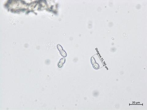 Diplocarpon coronariae