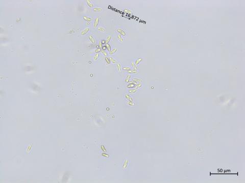 Colletotrichum_boninense_1