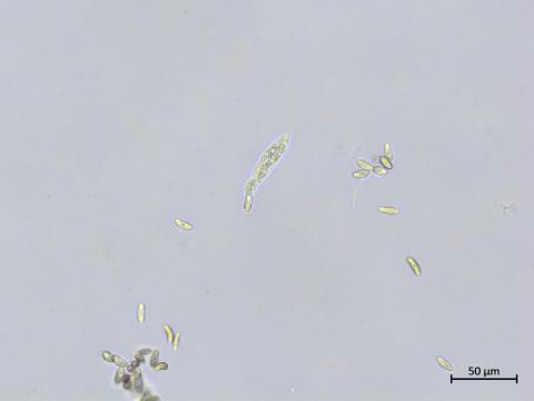 Colletotrichum_boninense_2
