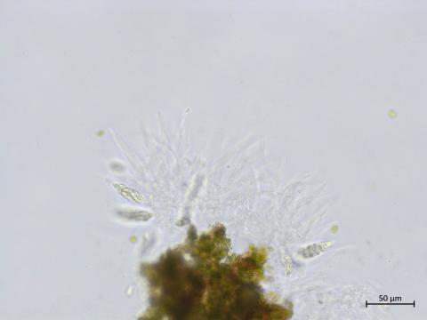 Colletotrichum_boninense_4