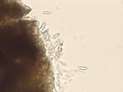 Colletotrichum_gloeosporioides_2
