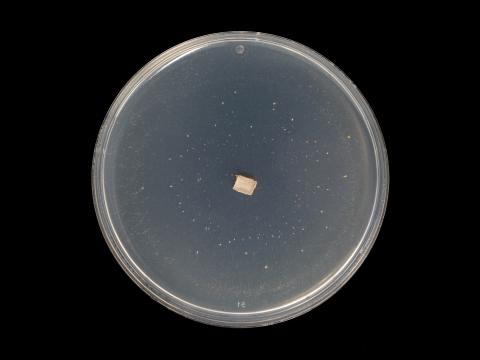 Colletotrichum_siamense_10