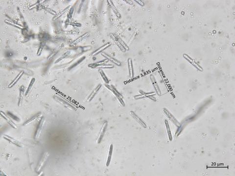 Coleophoma_empetri_3