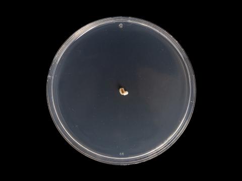 Diplocarpon_fragariae_1