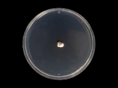 Diplocarpon_fragariae_2