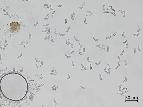 Diplocarpon_fragariae_6