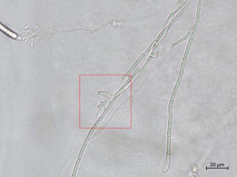 Fusarium_sambucinum_7