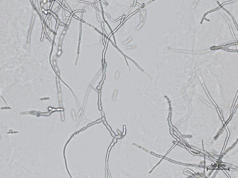 Fusarium_sambucinum_8