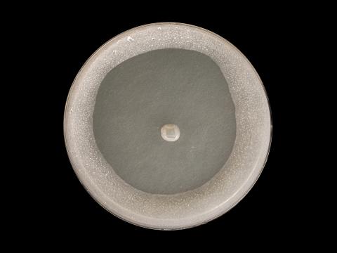 Globisporangium_irregulare_7