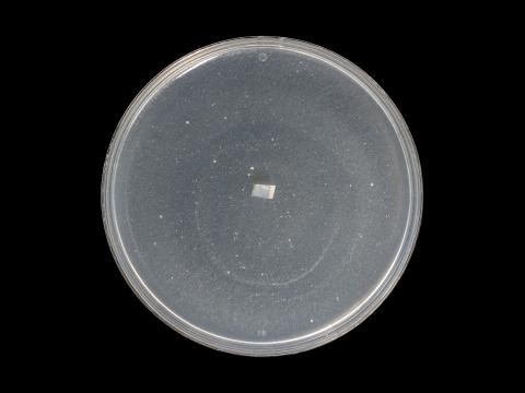 Globisporangium_irregulare_8