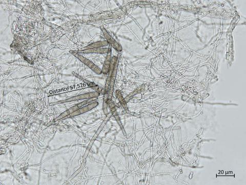 Helminthosporium_solani_8