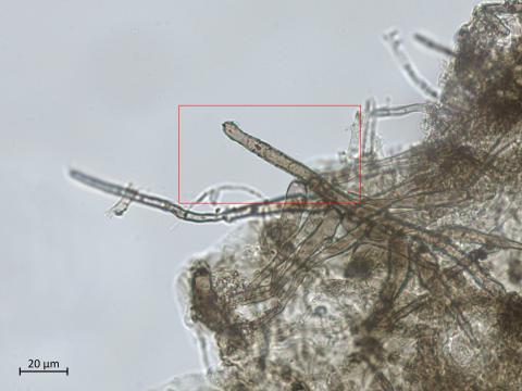 Helminthosporium_solani_9