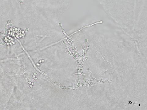 Ilyonectria_liriodendri_1