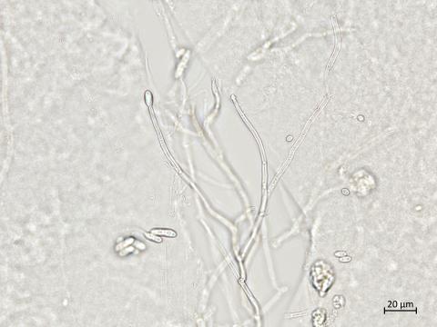 Ilyonectria_liriodendri_2