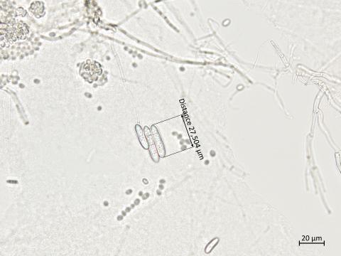 Ilyonectria_liriodendri_3