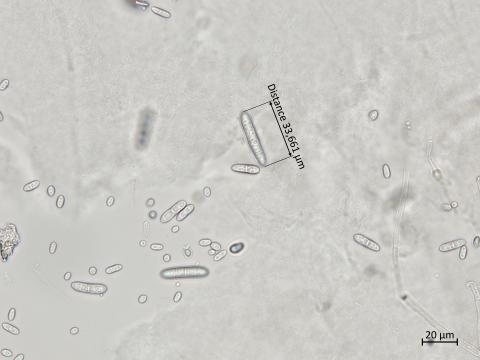 Ilyonectria_liriodendri_4