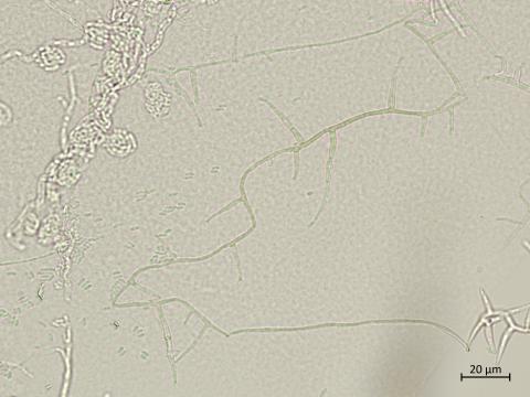 Phaeoacremonium_minimum_7