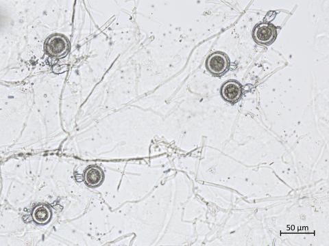 Phytophthora_erythroseptica_6