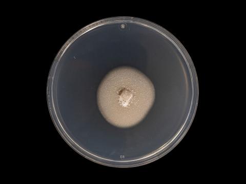 Plectosphaerella_cucumerina_6