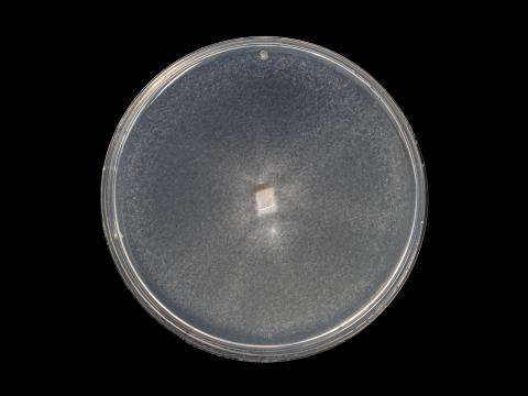 Verticillium_dahliae_10