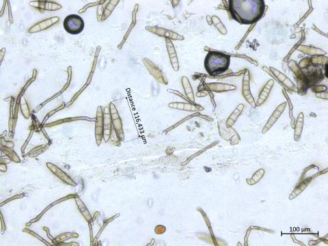 Exserohilum_turcicum_1