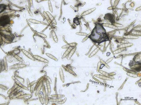 Exserohilum_turcicum_2