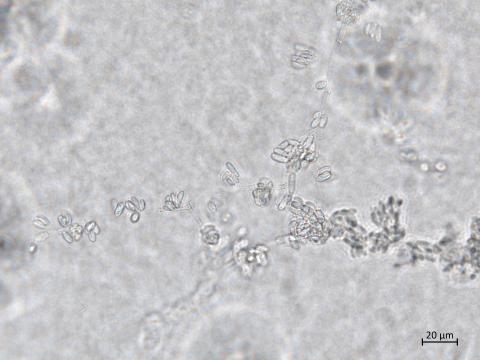 Aureobasidium_pullulans_5