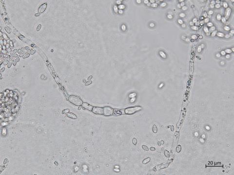 Aureobasidium_pullulans_6