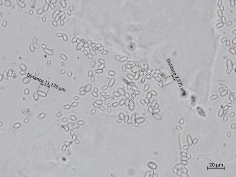 Aureobasidium_pullulans_7