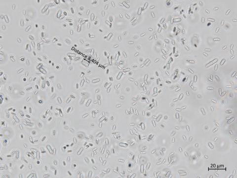 Cadophora_luteo-olivacea_8