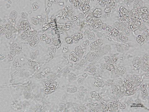 Cadophora_luteo-olivacea_7