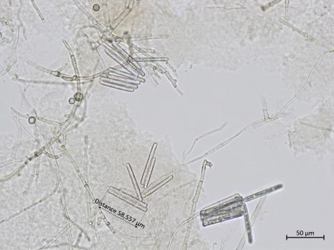 Calonectria_canadiana_1