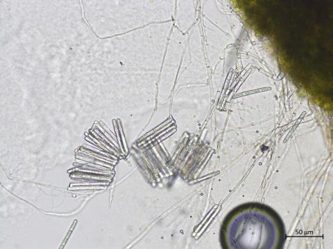 Calonectria_canadiana_3