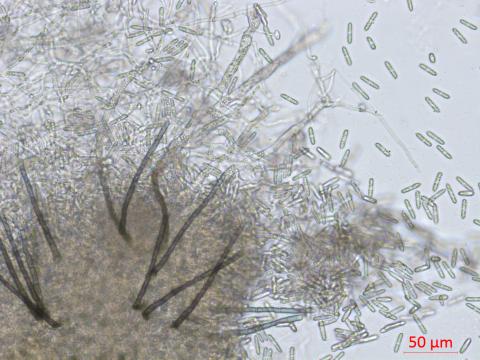Colletotrichum_sp_3