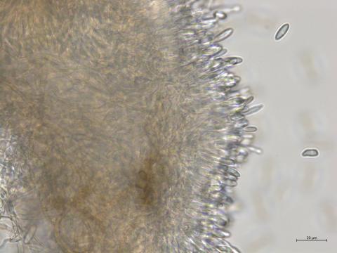 Colletotrichum_sp_5