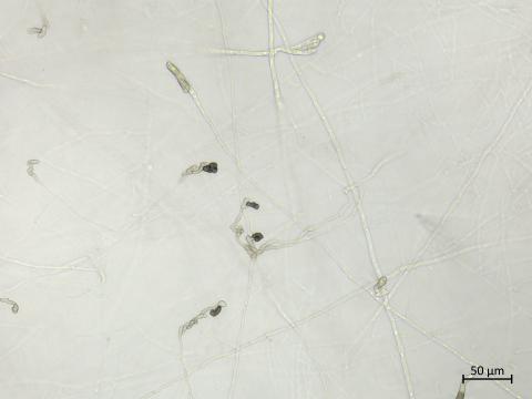 Colletotrichum_sp_1