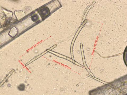Corynespora_cassiicola_1