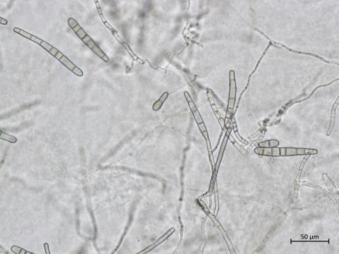 Corynespora_sp_2