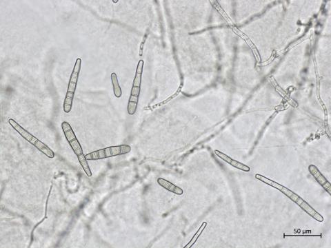 Corynespora_cassiicola_2